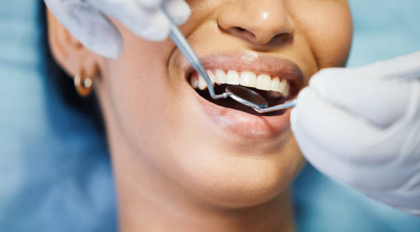 Best Pediatric Emergency Dentist in Brilliant, OH